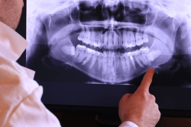 Best Broken or Chipped Tooth Repair in Pleasureville, KY